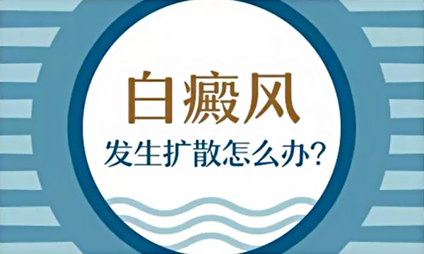 杭州白癜风复发的危害及预防是什么