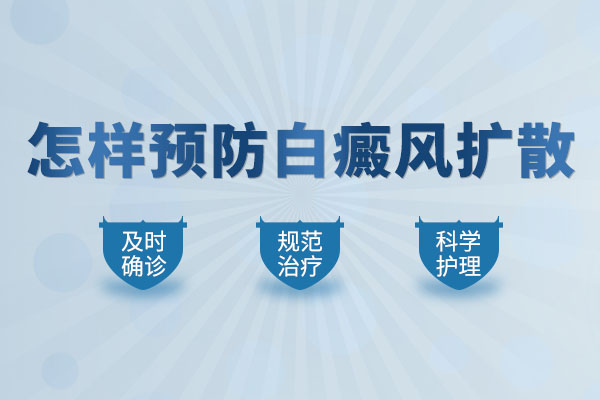 州哪所医院可以看白癜风?如何控制白癜风患者的白癜风扩散?